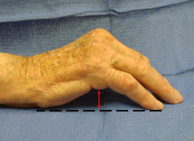 table-top-test-hand-surgery-resource